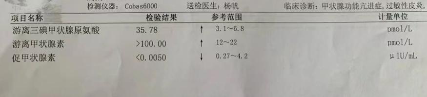 赛治什么时候能换成丙硫,赛治和丙硫转换要多久才能适应