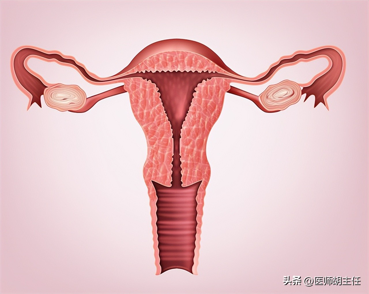 女性为什么容易长子宫肌瘤？提醒：平时尽量避免3个行为，别忽视