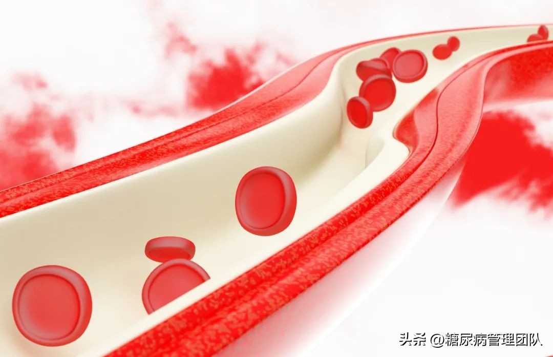 2024糖尿病管理指南,2024糖尿病指标参考值美国