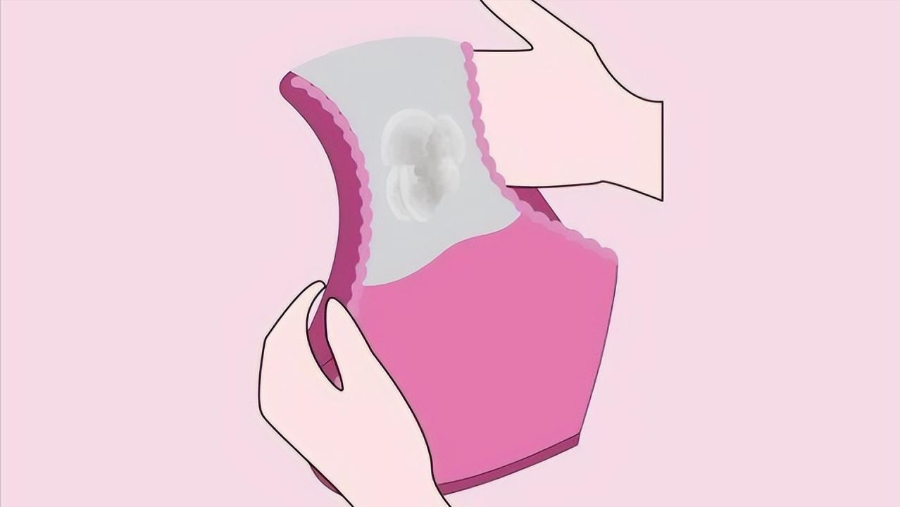 女人分泌物变多，不一定是需求强！还要小心妇科疾病找上门！
