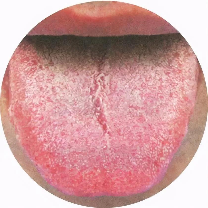 手玩多年，想法多，但“状态”差，看中医如何一方化解