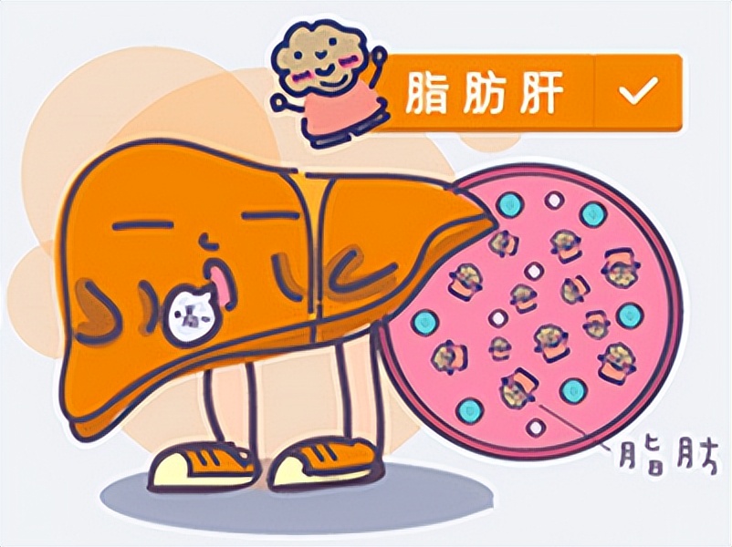 年轻人重度脂肪肝怎么办,脂肪肝多久发展成重度脂肪肝