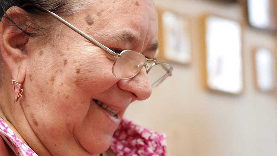 牙膏老年斑的克星,牙膏原来是治老年斑的特效药