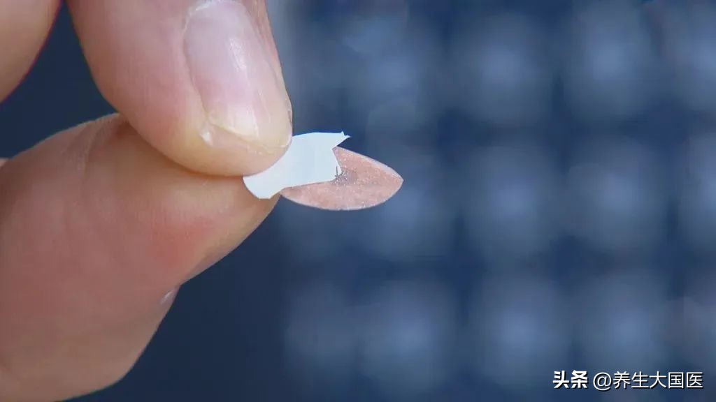 手脚血管突然明显凸起,心脏血管三高怎么预防