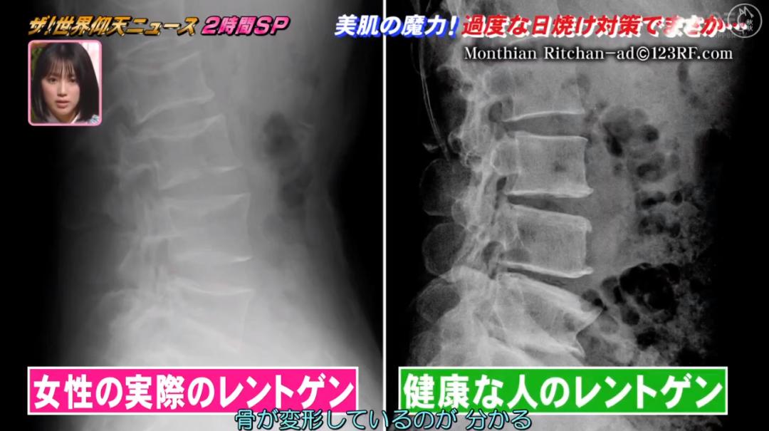 日本漂亮小姐姐不想被晒黑，每天全副武装！2年后身高竟缩水7cm…