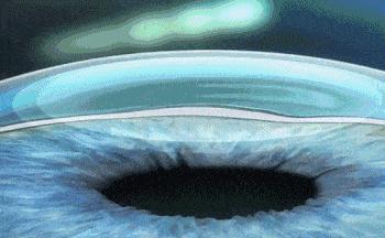 南阳南石医院近视眼手术价格表,南阳南石医院近视激光手术多少钱