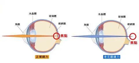 路边摊的老花镜可以用吗,千万不要买路边摊老花镜