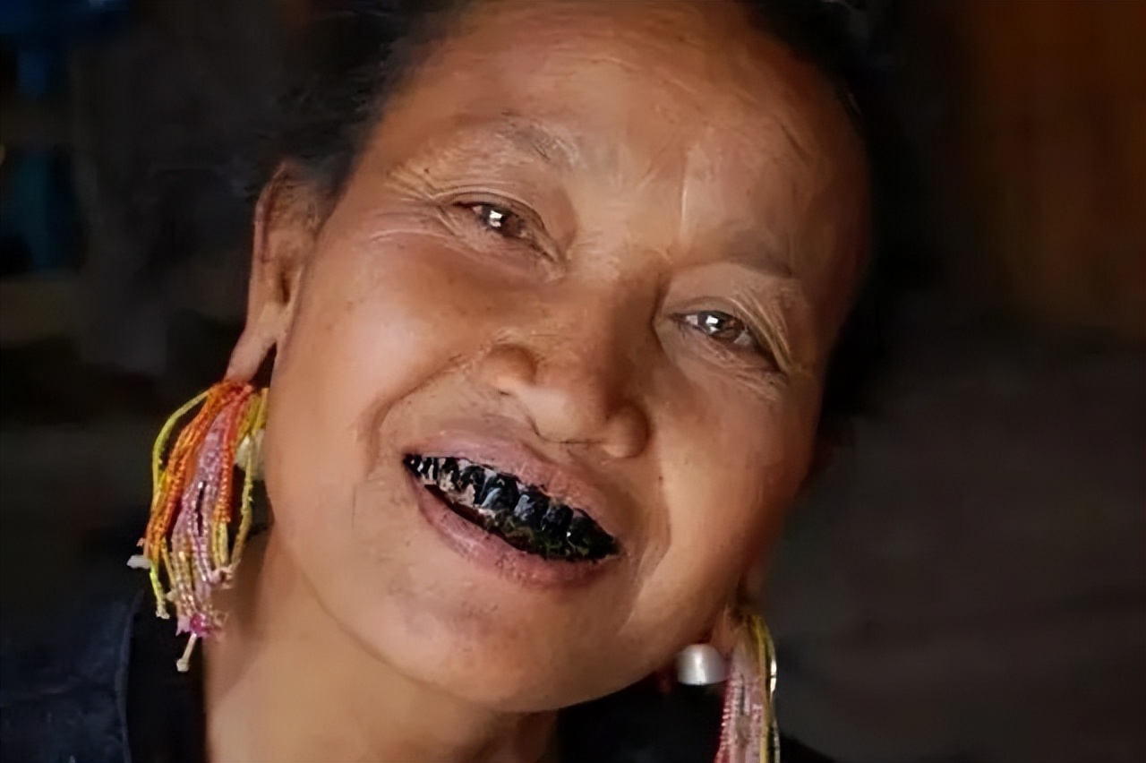 一级致癌物槟榔的危害有哪些,槟榔为什么被列为一级致癌物