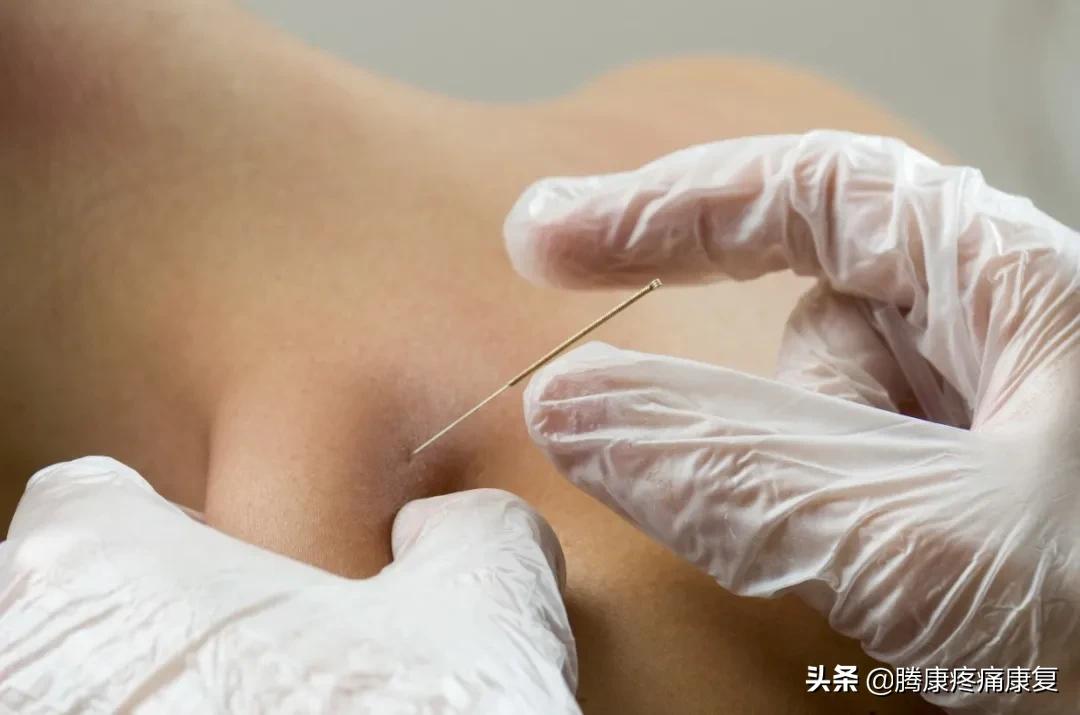 女性左侧软组织疼痛,常见疼痛类型有哪些特点