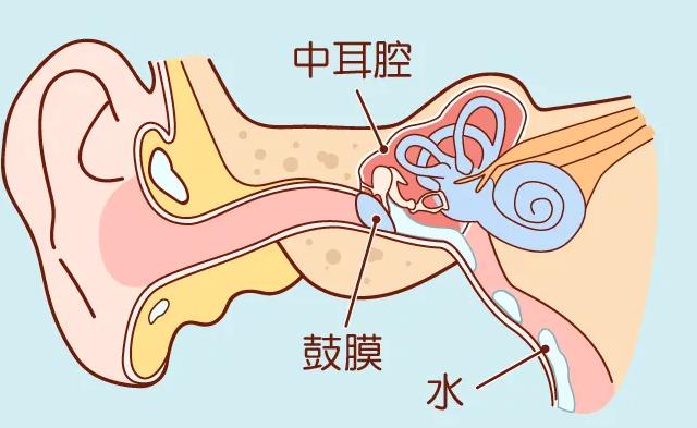 如果蚊子飞进耳朵怎么样,蚊子飞进鼻子有什么感觉