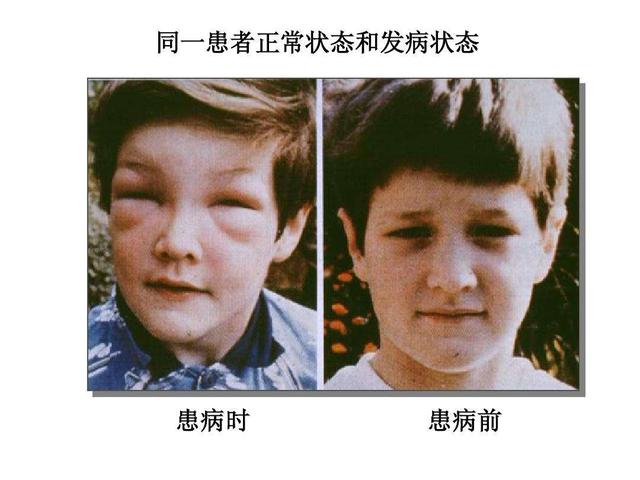 肾透支有什么症状,肾透支会有哪些症状