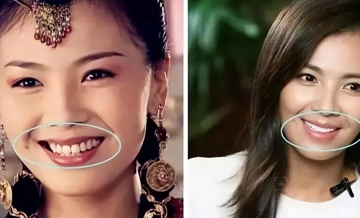 骨瘦如柴面如死灰图,骨瘦如柴审美