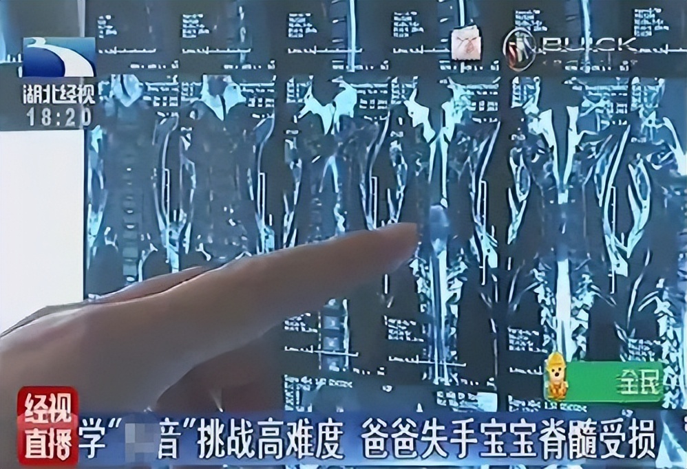 韩国梨泰院*踏事踩**件，154人遇难：别怕落伍错过一场热闹