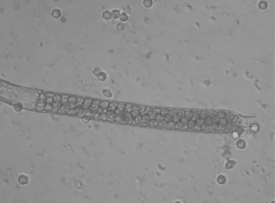 水产养殖霉菌怎么处理,水产养殖杀水霉方法