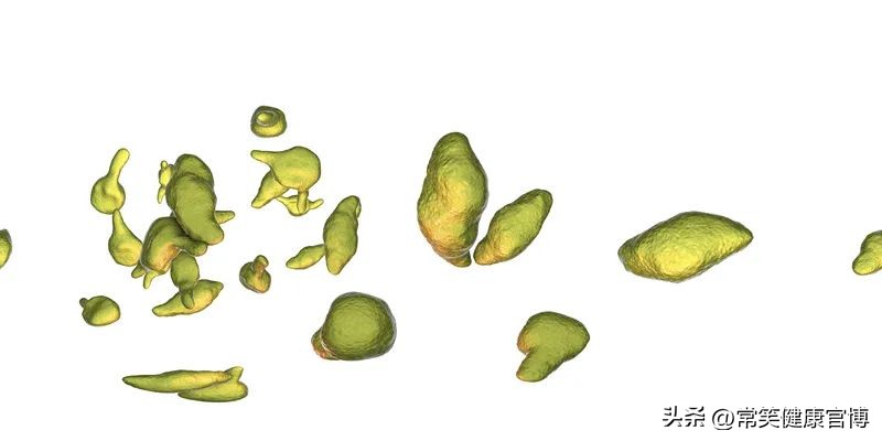 支原体感染者应注意什么,什么是支原体感染如何避免