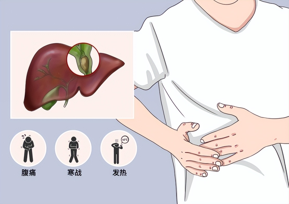 全身炎症反应会导致多器官功能障碍综合征，中西医如何治疗？