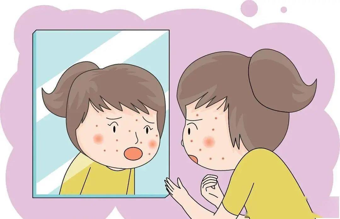 30岁脸上痘痘反反复复是什么原因,脸上的痘痘总是反反复复为什么