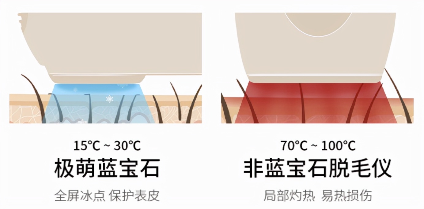 ulike脱毛仪凭什么这么贵,ulike脱毛仪全系列产品测评