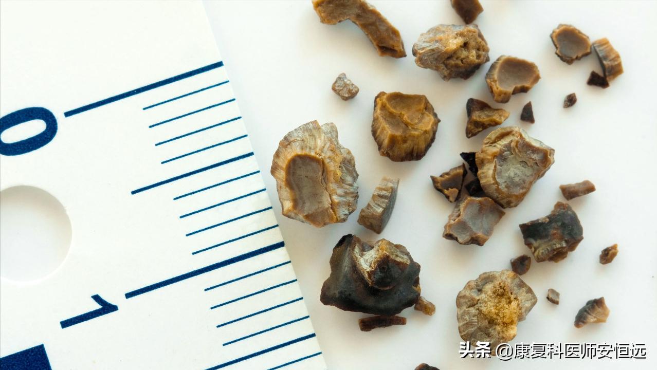 世上最疼的病是什么病？临床上这3种“疼痛”，经历过的都是超人