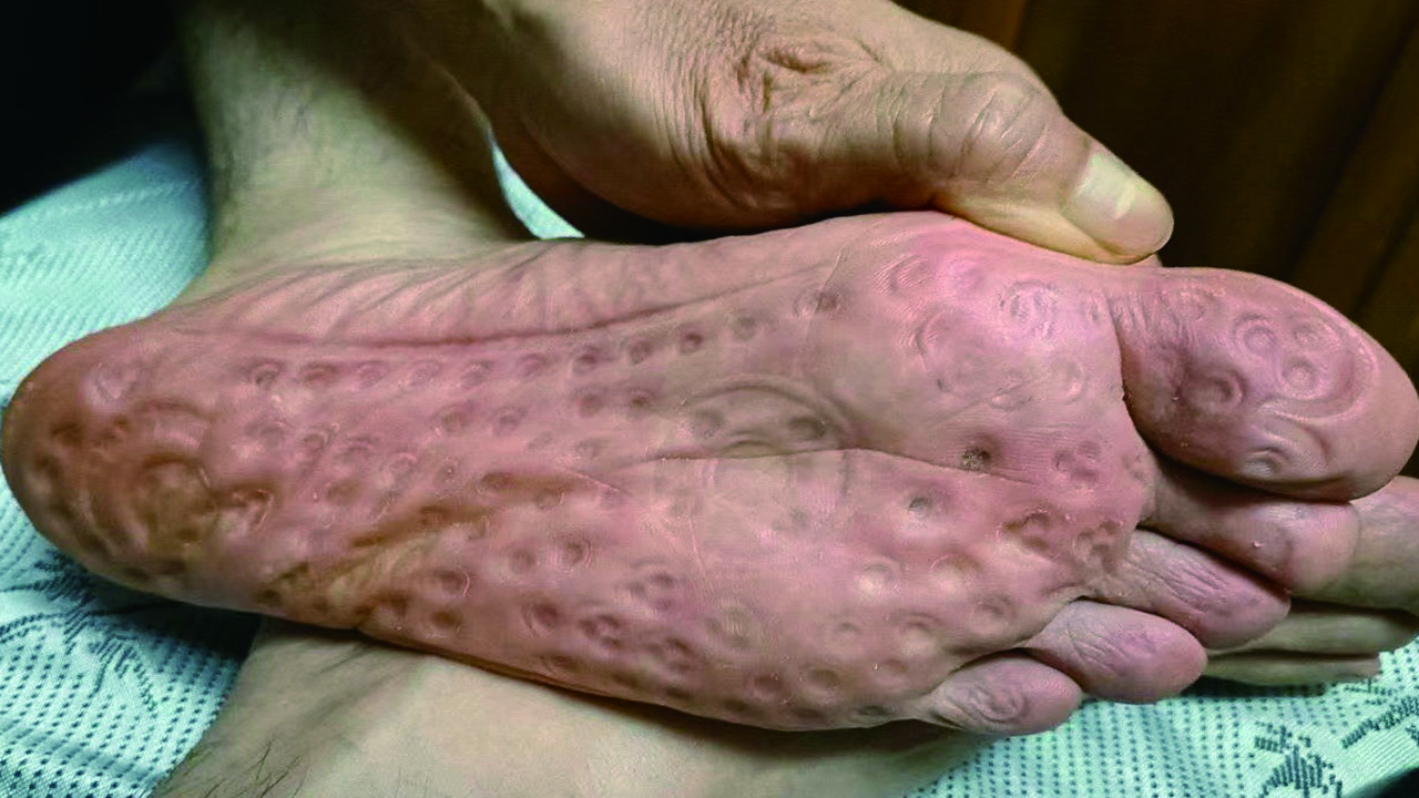 精油按摩养生袜,足疗袜真的有用吗