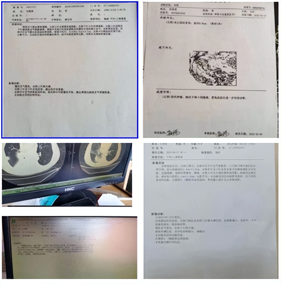 陈海林治疗癌症,陈海林肿瘤名医