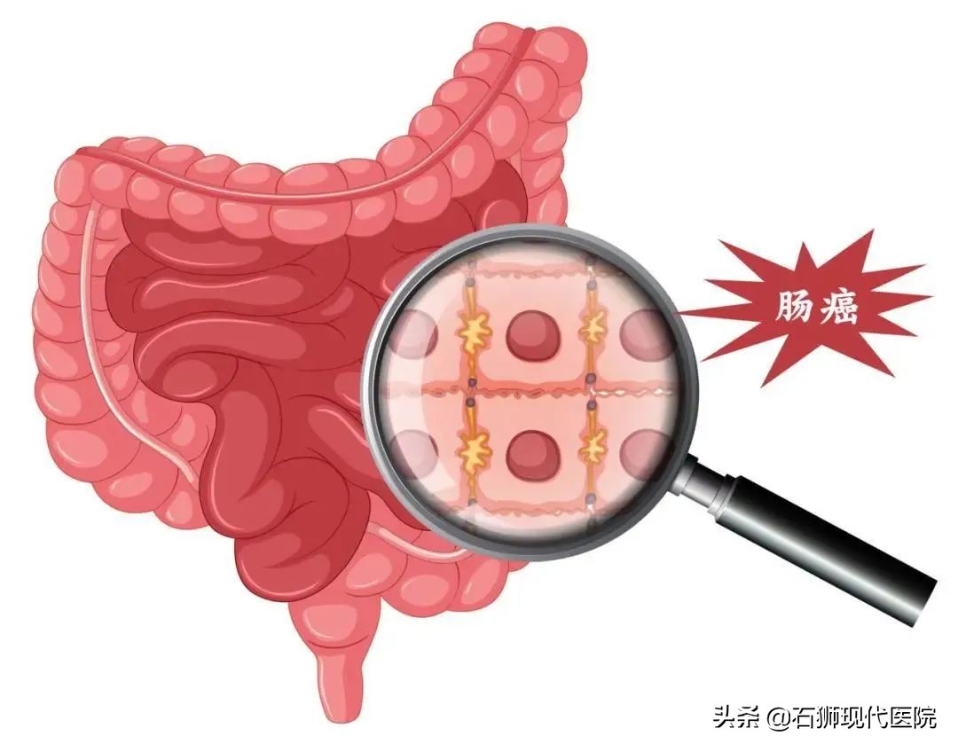 肛门处有分泌物如何自我判断？有哪些应急处理方法？