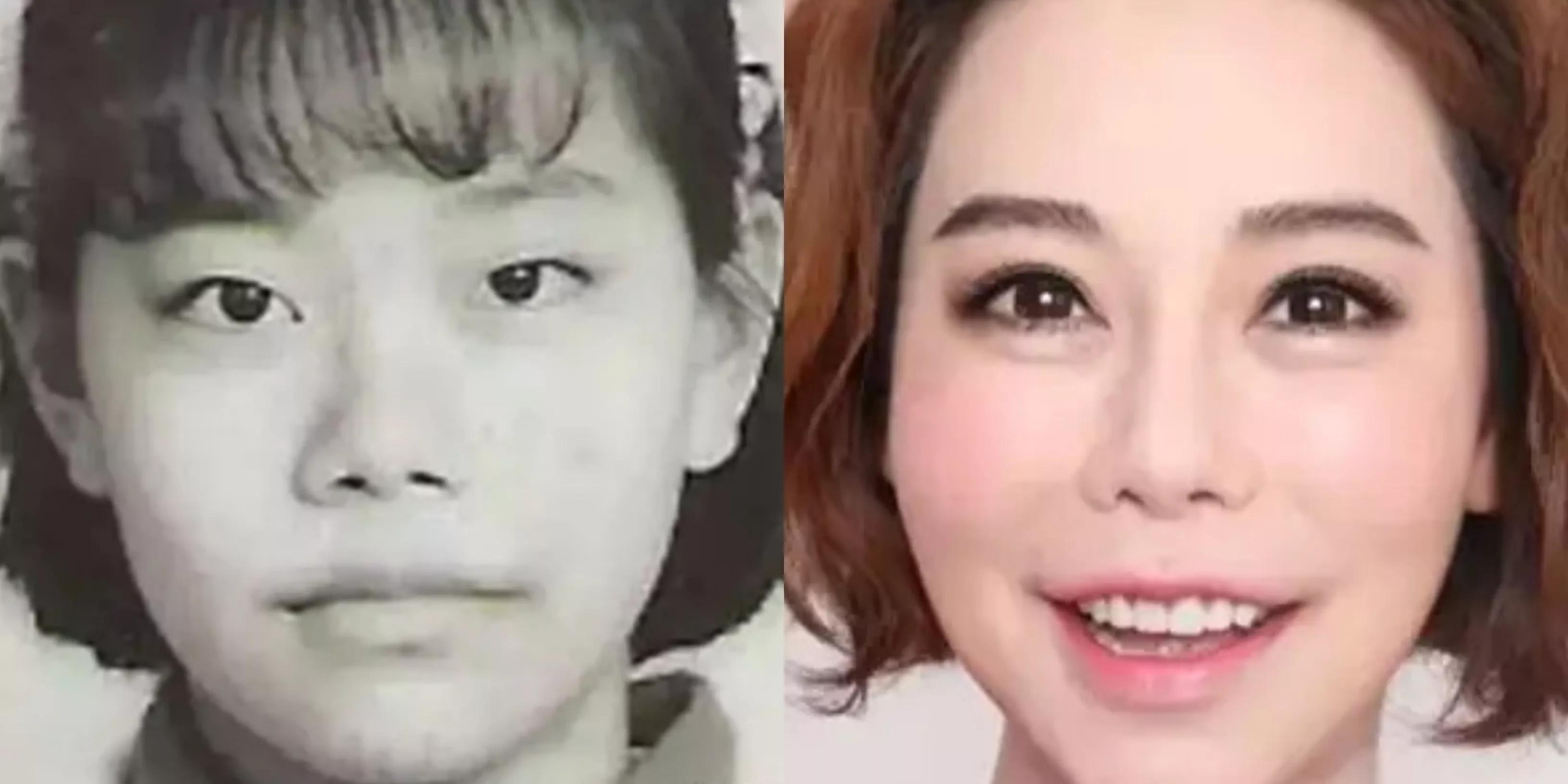 盘点那些整容整的最厉害的人,整容整的最厉害的三位女士