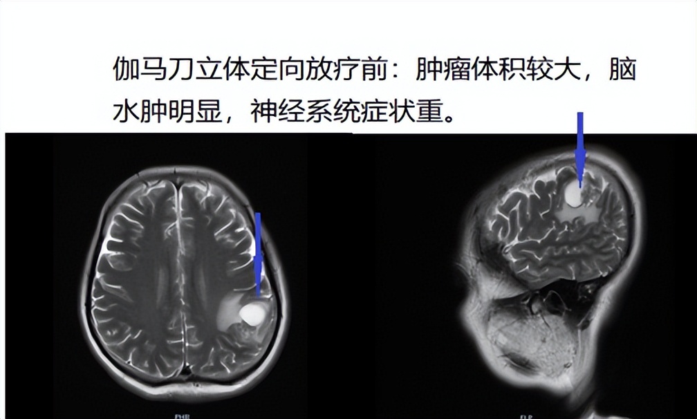 高质量发展！前进中的河北工程大学附属医院肿瘤中心
