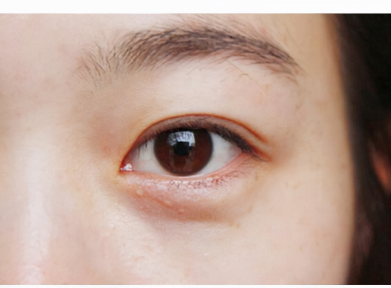 左眼皮或右眼皮跳有什么预兆,左眼皮上眼皮跳是好运还是厄运