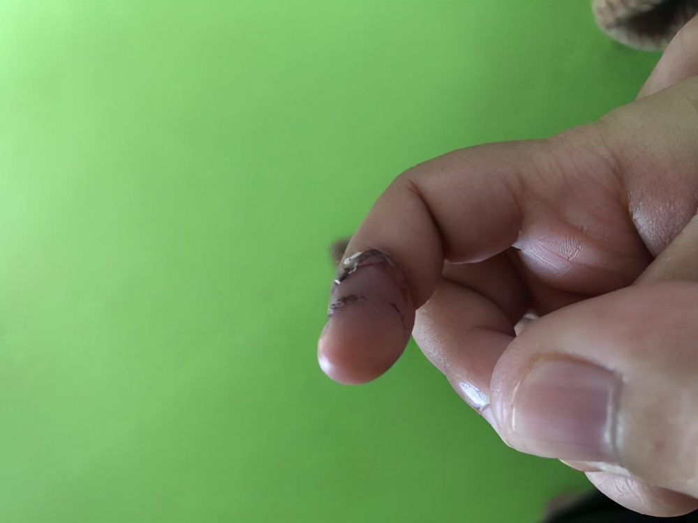 兔子为什么咬小孩的手指,兔子咬断11个月大小孩手指