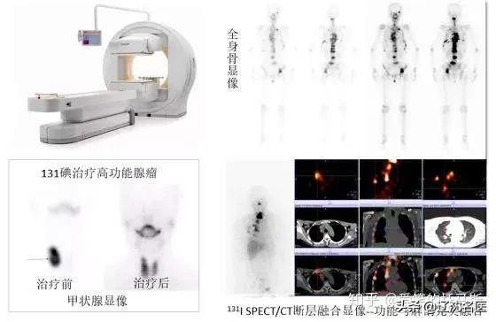 核医学科普知识类短视频,核医学科要住院的吗