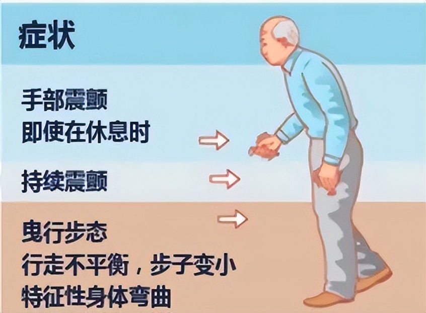 郭爱顺：精湛医技让生命不再颤抖DBS手术受益患者重获新生