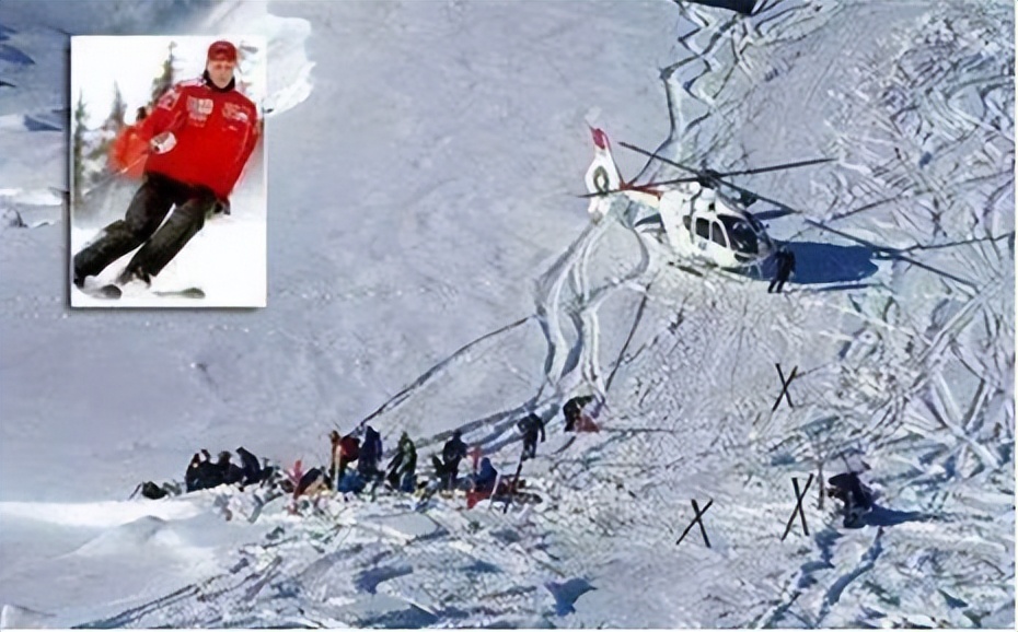 车王舒马赫怎么成为的植物人,车王舒马赫醒了妻子倾家荡产