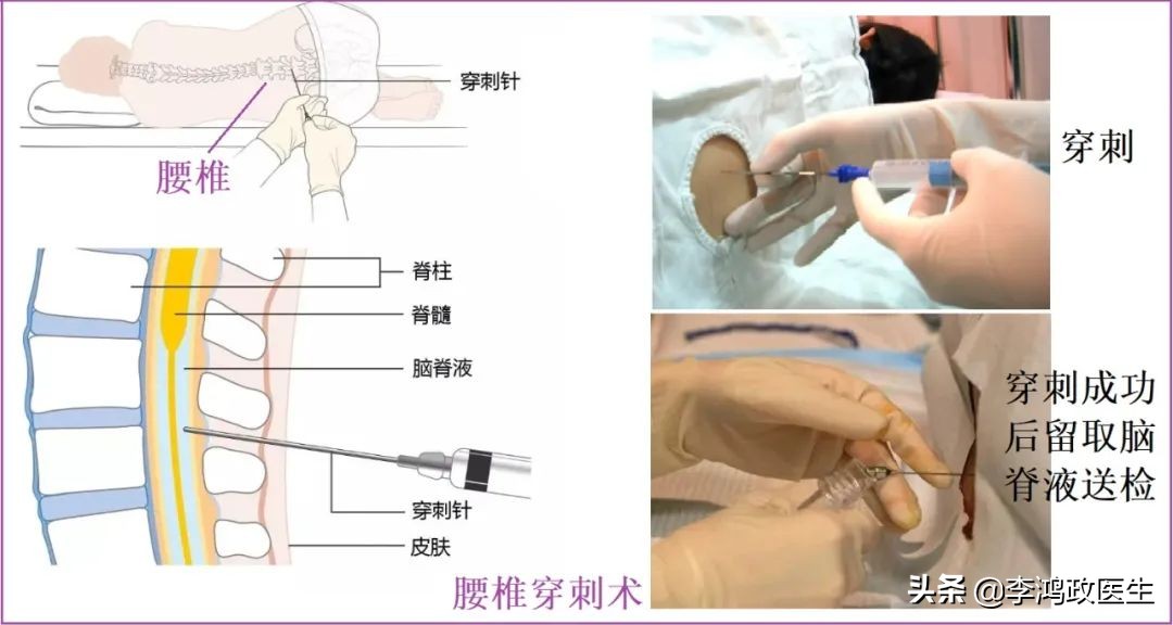 阳性女子发烧说胡话,女子发烧到40度说胡话