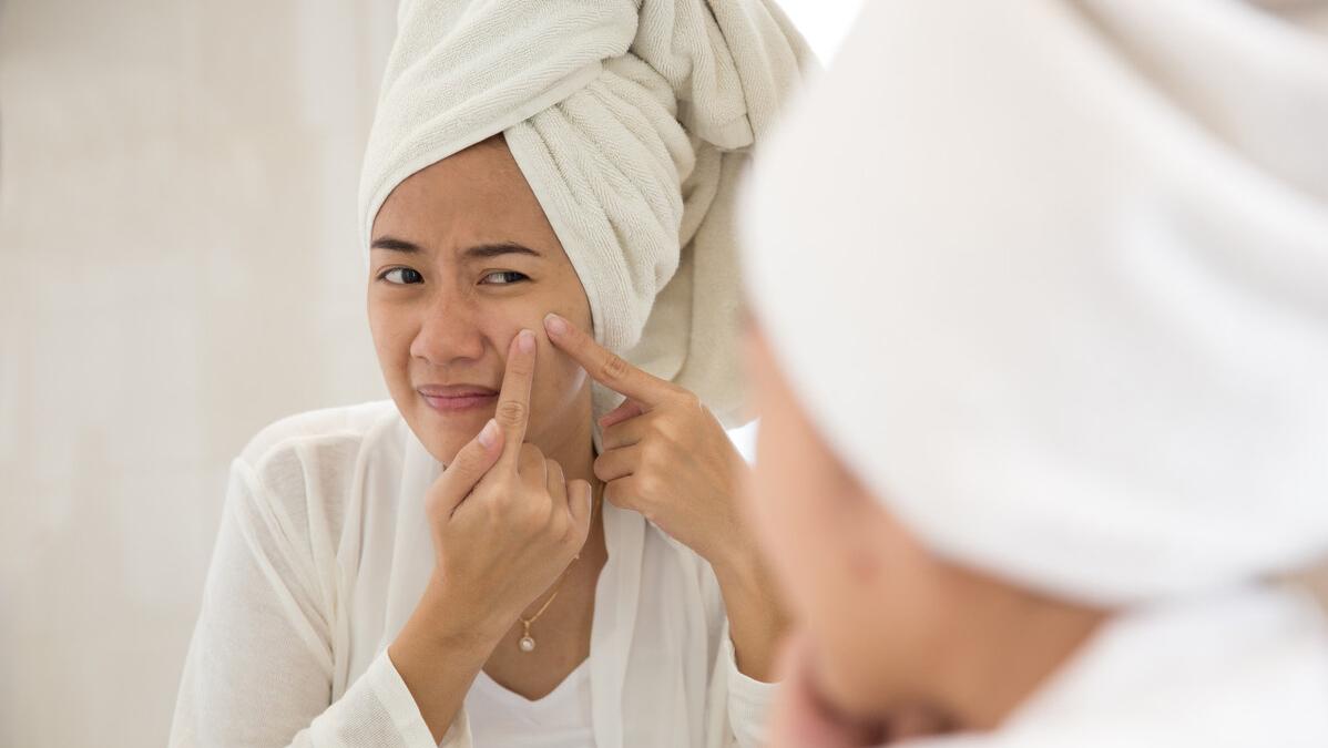 水杨酸适合爆痘的人使用吗,水杨酸抗痘