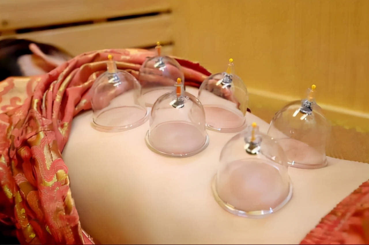 拔火罐后背吸出来的瘀血,拔火罐吸出的瘀血是真的吗