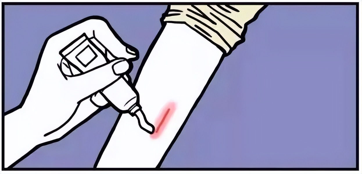 除疤的误区有哪些,有办法除疤吗