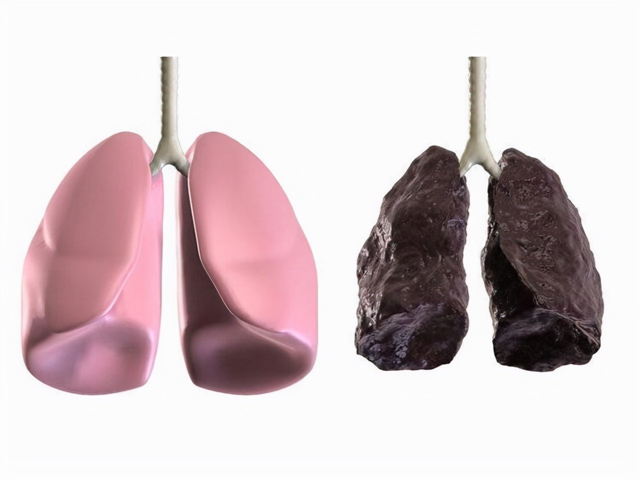 小伙喝下百草枯被医生抢救回来,29岁小伙喝下百草枯农药拒绝治疗