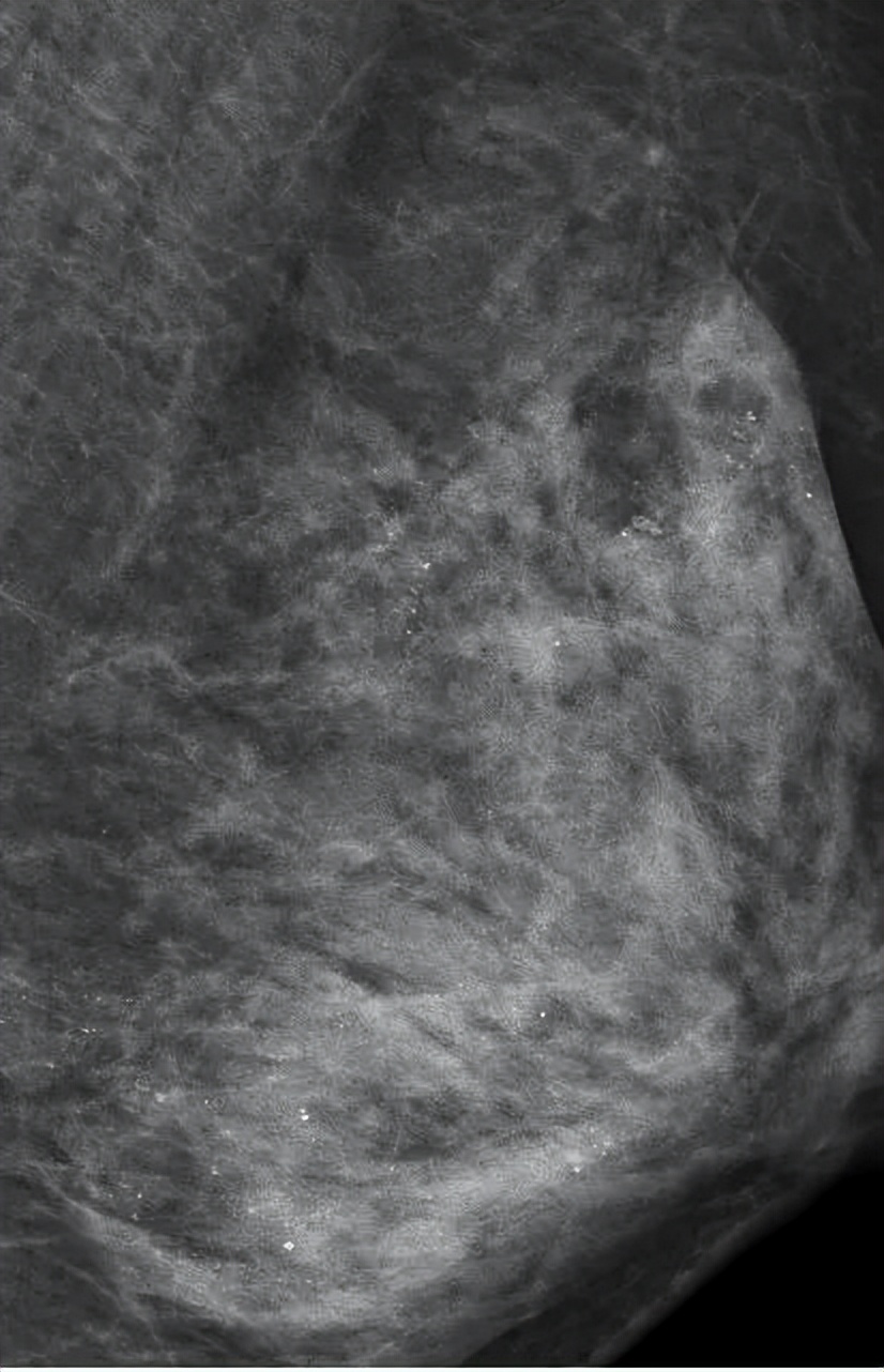 被捏碎乳腺的女人