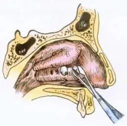 爱耳小知识,爱耳日科普