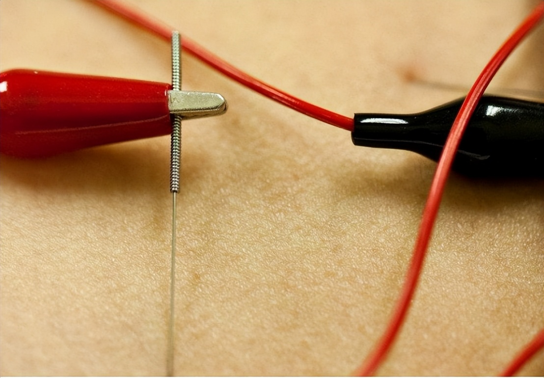 原发性三叉神经痛有治好的吗,原发性三叉神经痛怎么治疗有效