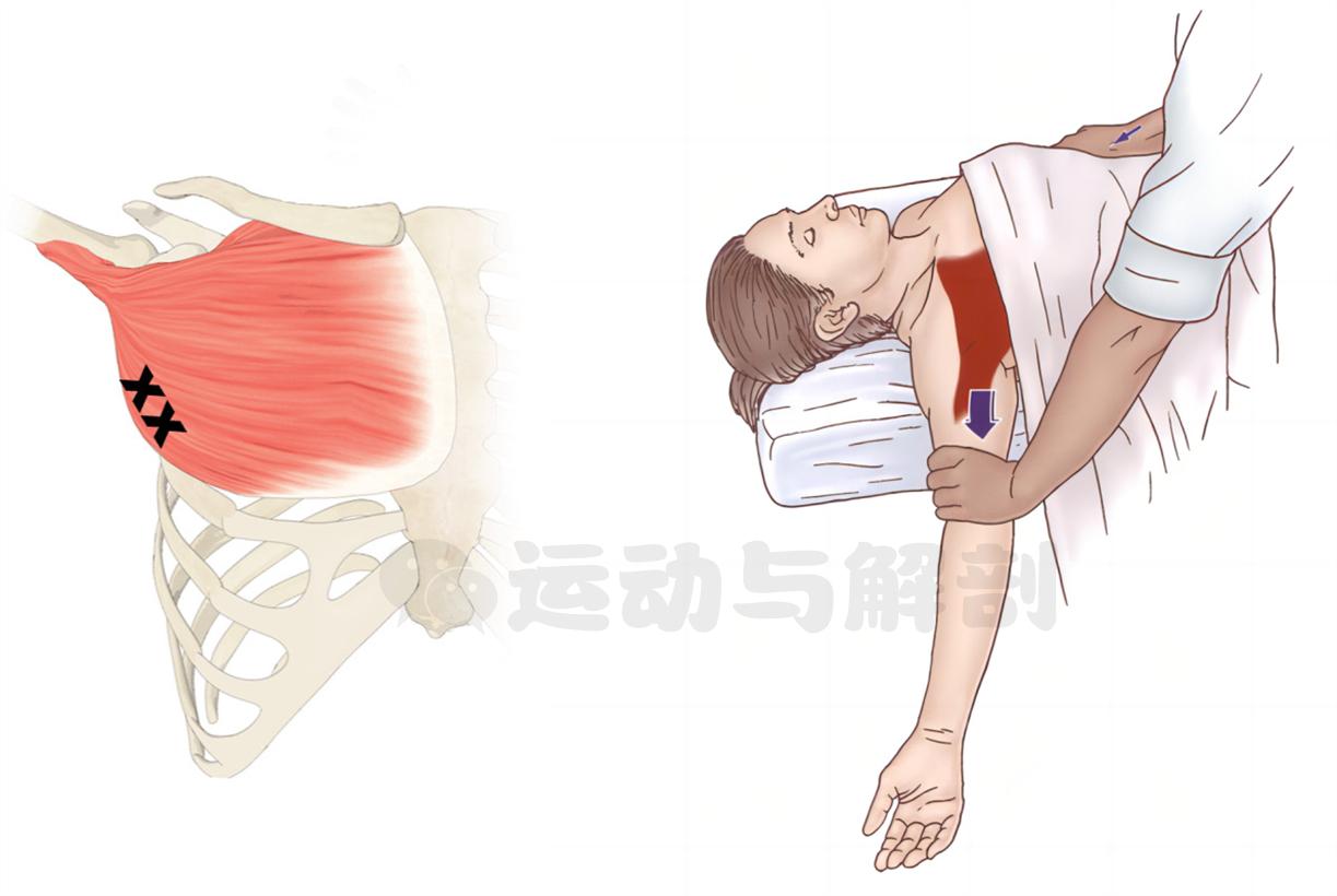 胸大肌太紧了怎么办？切记不要直接拉伸！