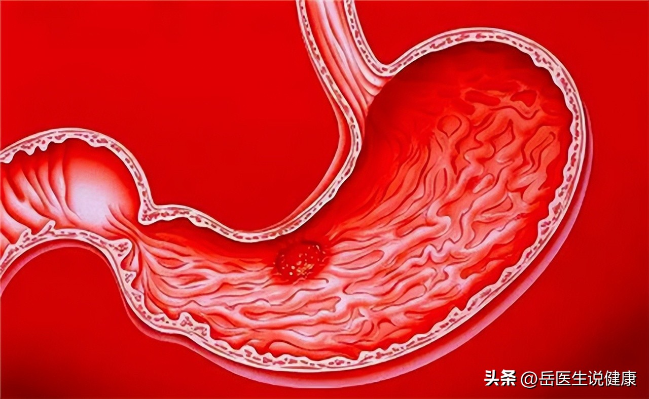 谷维素治疗失眠怎么服用最安全,谷维素是治疗失眠高血脂的良药