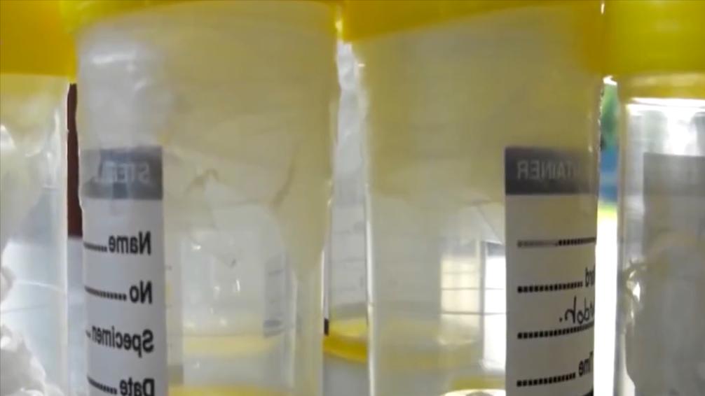 盘点十种神奇动物的价格,盘点五种有巨毒的生物