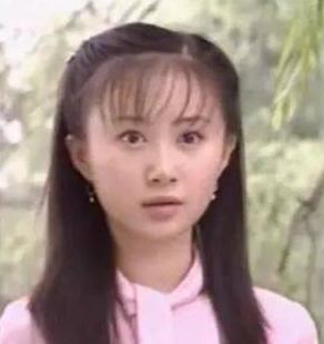 假下巴前后对比,假下巴