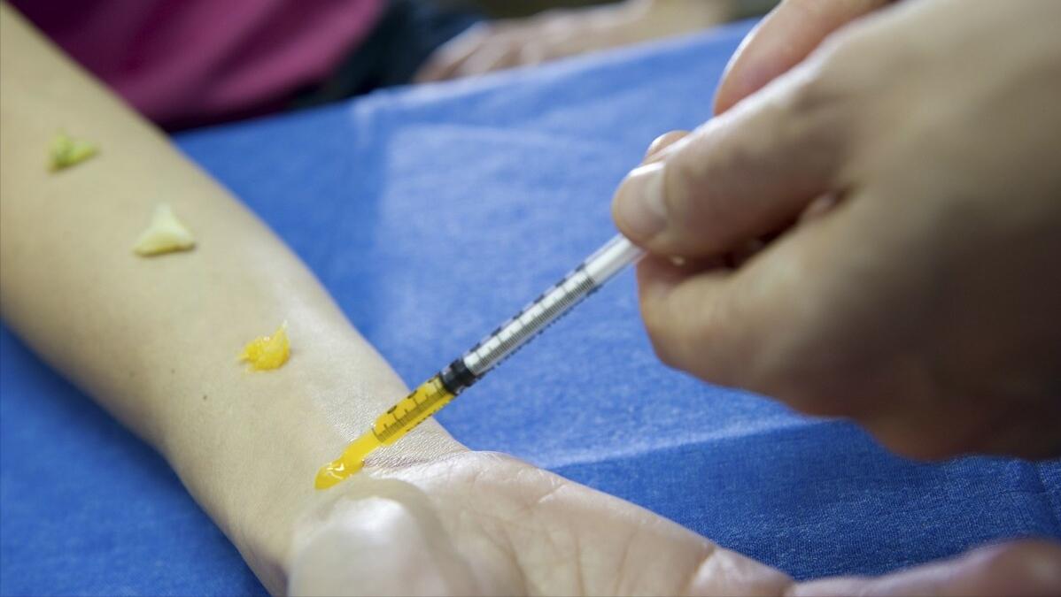 阿莫西林要认清楚，只对6种病有效！用对是个宝，用错是毒药