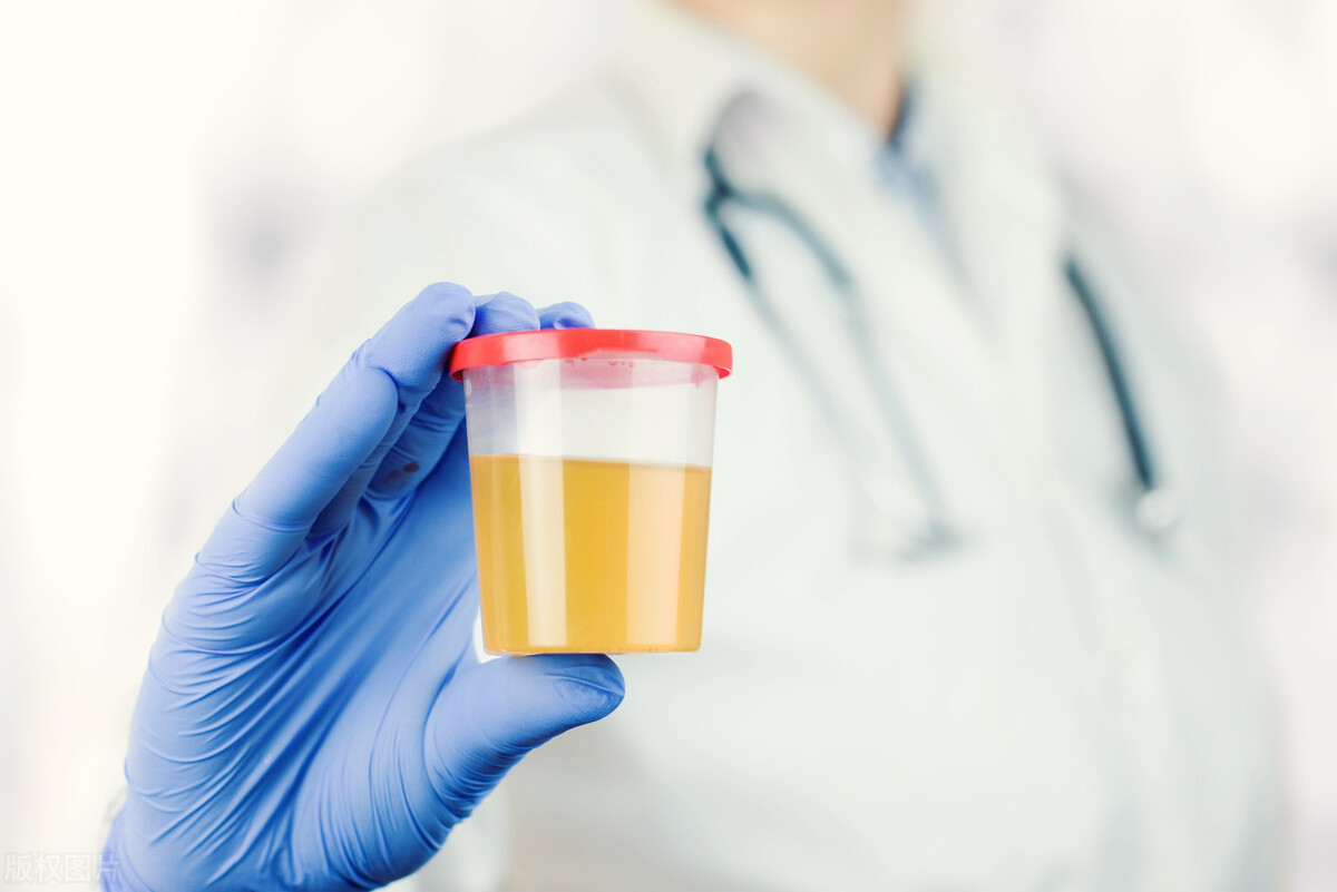 43岁女性肾病诊断,43岁女子双脚浮肿半年