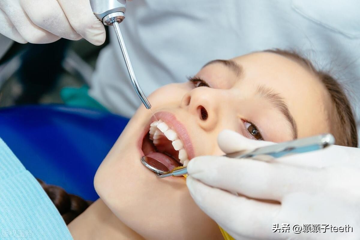 洗牙的危害相关推荐,经期洗牙有什么危害