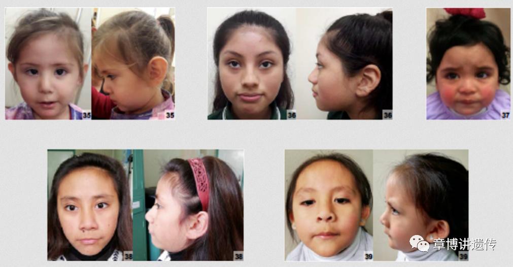 做了携带者筛查还做羊水穿刺吗,做核酸检测医生救人