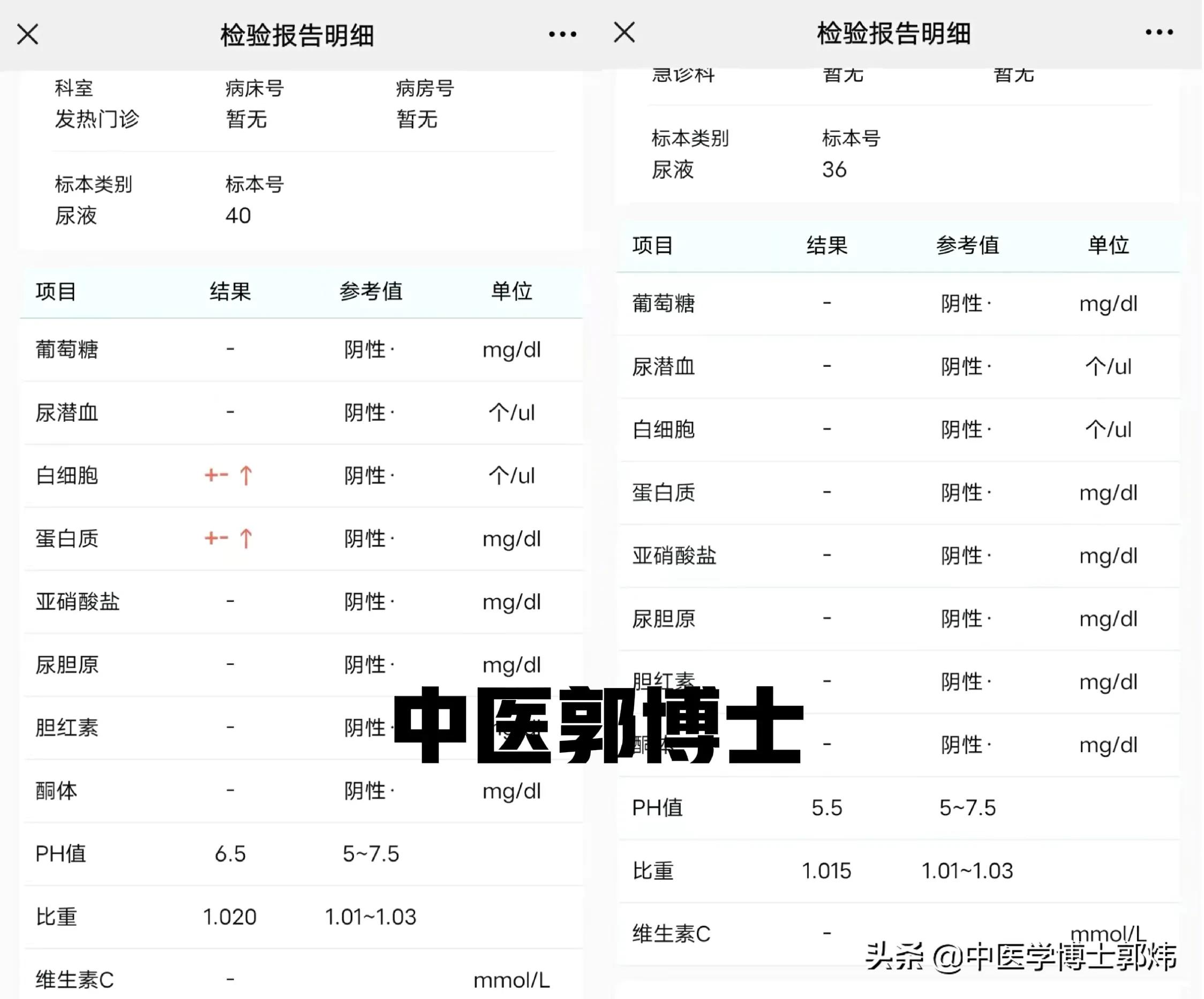 经方治疗色素性紫癜,紫癜中药可以治好吗